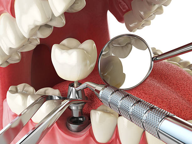 Best Emergency Denture Repair in Blowing Rock, NC